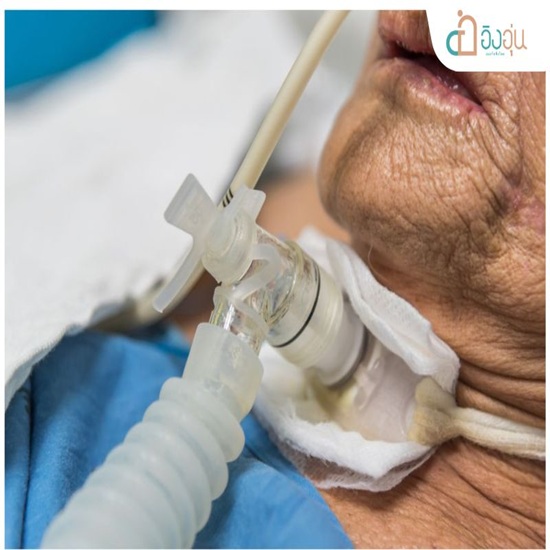 ดูแลผู้ป่วยติดเตียง